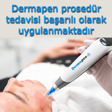 Adsız (14)